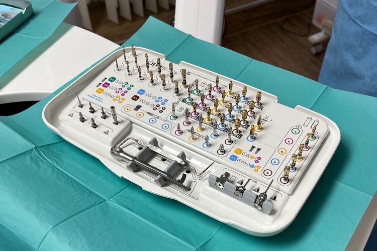 Zahnimplantate bei Zahnverlust – sichere und langlebige Lösung